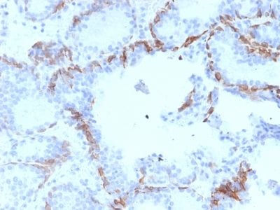 Cytokeratin 6A Monoclonal Mouse Antibody (KRT6A/2368)