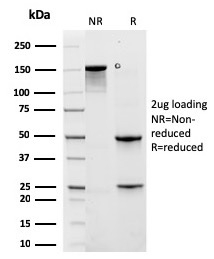 Cytokeratin 6A Recombinant Monoclonal Mouse Antibody (rKRT6A/2100)