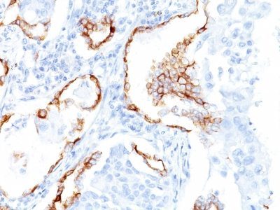 Cytokeratin 7 Monoclonal Mouse Antibody (K72.7)
