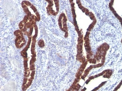 Cytokeratin 7 Monoclonal Mouse Antibody (K72.7)