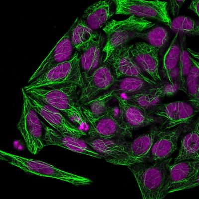 Cytokeratin 7 Monoclonal Mouse Antibody (KRT7/1198)