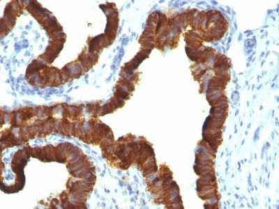 Cytokeratin 7 Monoclonal Mouse Antibody (KRT7/1198)