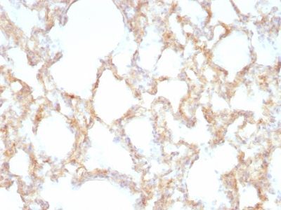 Cytokeratin 7 Monoclonal Mouse Antibody (KRT7/1198)