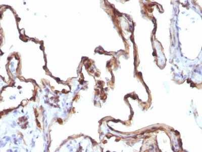 Cytokeratin 7 Monoclonal Mouse Antibody (KRT7/1198)
