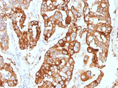 Cytokeratin 7 Monoclonal Mouse Antibody (KRT7/2200)