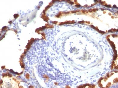 Cytokeratin 7 Monoclonal Mouse Antibody (KRT7/760 + KRT7/903)
