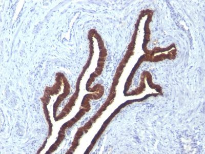 Cytokeratin 7 Monoclonal Mouse Antibody (KRT7/760 + KRT7/903)