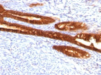 Cytokeratin 7 Monoclonal Mouse Antibody (KRT7/760 + KRT7/903)