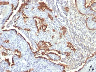 Cytokeratin 7 Monoclonal Mouse Antibody (KRT7/760 + OV-TL12/30)