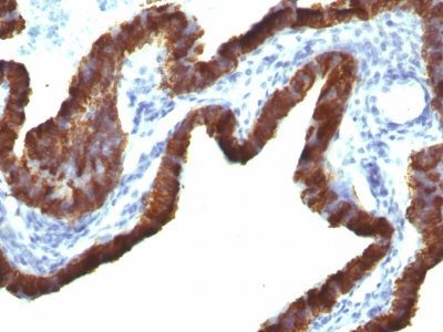 Cytokeratin 7 Monoclonal Mouse Antibody (KRT7/760 + OV-TL12/30)