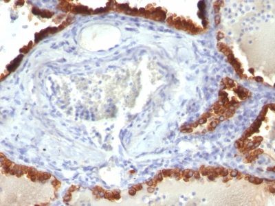 Cytokeratin 7 Monoclonal Mouse Antibody (KRT7/760)
