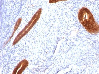 Cytokeratin 7 Monoclonal Mouse Antibody (KRT7/760)