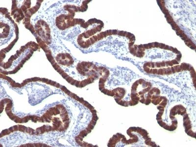 Cytokeratin 7 Monoclonal Mouse Antibody (KRT7/760)