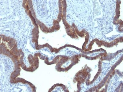 Cytokeratin 7 Monoclonal Mouse Antibody (KRT7/903)