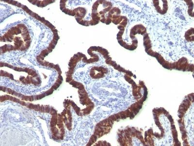 Cytokeratin 7 Monoclonal Mouse Antibody (OV-TL12/30)