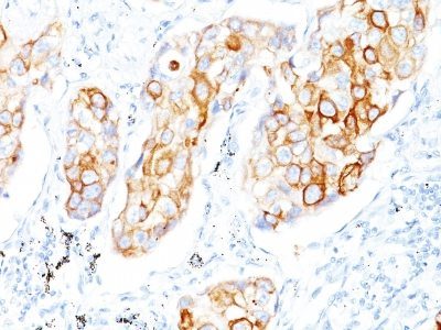 Cytokeratin 7 Monoclonal Mouse Antibody (OV-TL12/30)