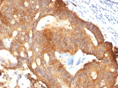 Cytokeratin 8 Monoclonal Mouse Antibody (B22.1)