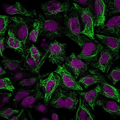 Cytokeratin 8 Monoclonal Mouse Antibody (C-43)
