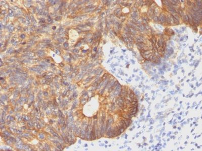 Cytokeratin 8 Monoclonal Mouse Antibody (C-43)
