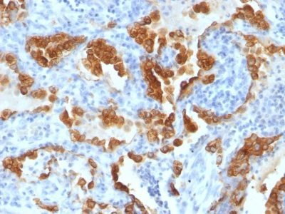 Cytokeratin 8 Monoclonal Mouse Antibody (H1 + TS1)