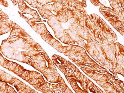 Cytokeratin 8 Monoclonal Mouse Antibody (H1)