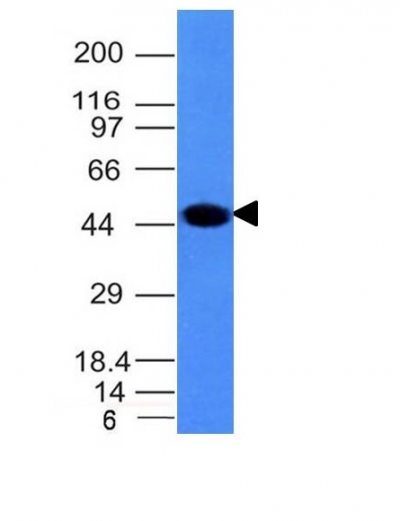 Cytokeratin 8 Monoclonal Mouse Antibody (H1)