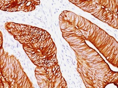 Cytokeratin 8 Monoclonal Mouse Antibody (K8.8)