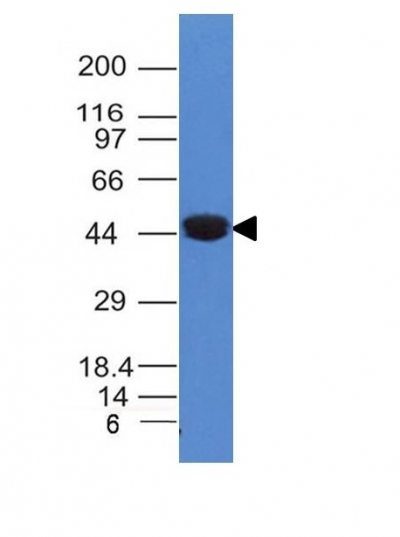 Cytokeratin 8 Monoclonal Mouse Antibody (K8/383)