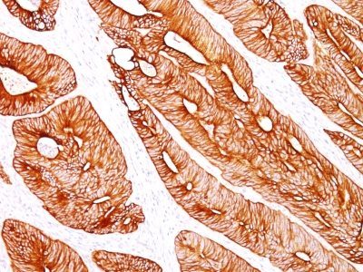 Cytokeratin 8 Monoclonal Mouse Antibody (K8/383)