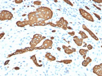 Cytokeratin 8 Monoclonal Mouse Antibody (KRT8/2115)
