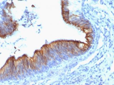 Cytokeratin 8 Monoclonal Mouse Antibody (KRT8/899)