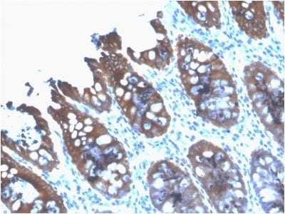 Cytokeratin 8 Recombinant Monoclonal Mouse Antibody (rB22.1)