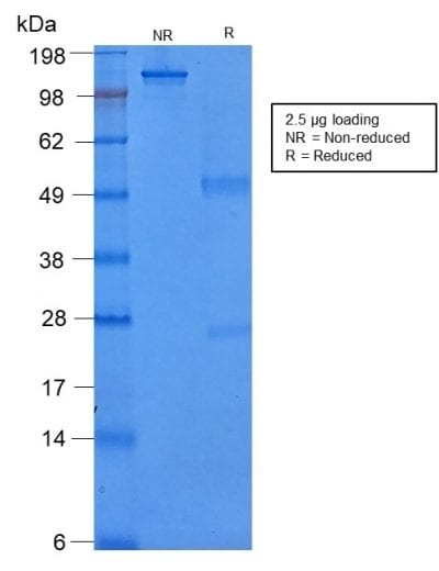 Cytokeratin 8 Recombinant Monoclonal Mouse Antibody (rB22.1)