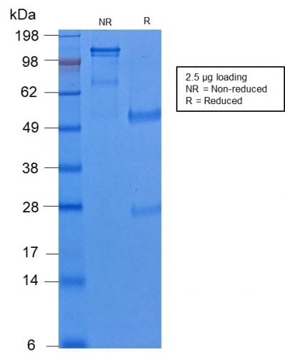 Cytokeratin 8 Recombinant Monoclonal Rabbit Antibody (KRT8/2174R)