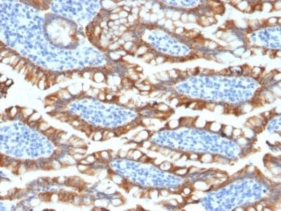 Cytokeratin 8 Recombinant Monoclonal Rabbit Antibody (KRT8/2174R)