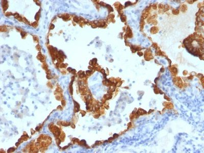 Cytokeratin 8/18 Monoclonal Mouse Antibody (C-43 + DC10)