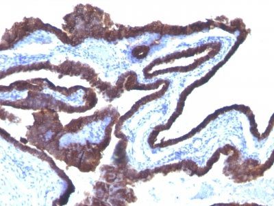 Cytokeratin 8/18 Monoclonal Mouse Antibody (C-43 + DC10)