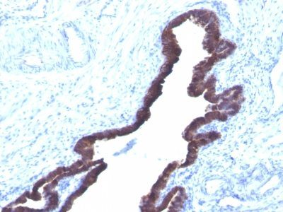 Cytokeratin 8/18 Monoclonal Mouse Antibody (K8.8 + DC10)