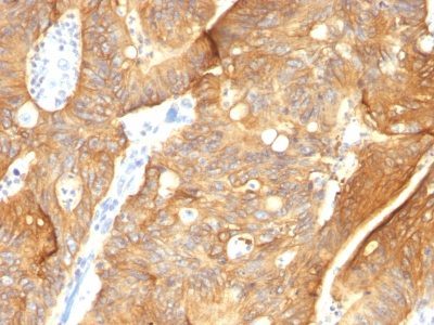 Cytokeratin 8/18 Monoclonal Mouse Antibody (K8.8 + DC10)