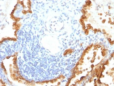 Cytokeratin 8/18 Monoclonal Mouse Antibody (KRT8/803 + KRT18/835)