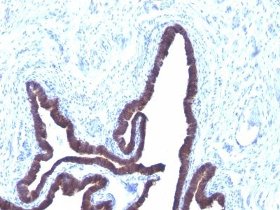 Cytokeratin 8/18 Monoclonal Mouse Antibody (KRT8/803 + KRT18/835)