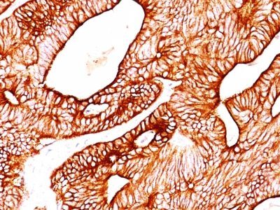 Cytokeratin 8/18 Monoclonal Mouse Antibody (KRT8/803 + KRT18/835)