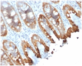 Cytokeratin 8/18 Recombinant Monoclonal Mouse Antibody (rKRT8.18/1346)
