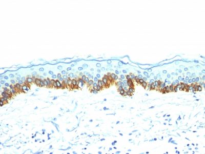 Cytokeratin, Acidic Monoclonal Mouse Antibody (AE-1)