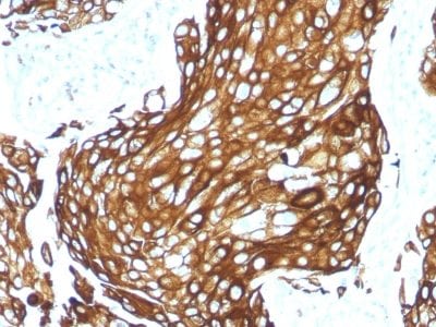Cytokeratin, Acidic Recombinant Monoclonal Rabbit Antibody (KRTL/1577R)