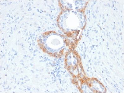 Cytokeratin, Basic Recombinant Monoclonal Mouse Antibody (rKRTH/2148)