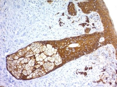 Cytokeratin, Basic Recombinant Monoclonal Rabbit Antibody (KRTH/1576R)