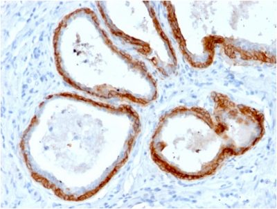 Cytokeratin, Basic Recombinant Monoclonal Rabbit Antibody (KRTH/2147R)