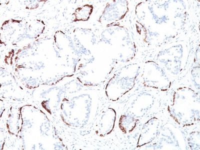 Cytokeratin, HMW Monoclonal Mouse Antibody (34BE12)