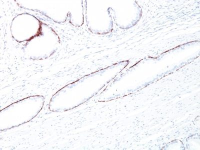 Cytokeratin, HMW Monoclonal Mouse Antibody (34BE12)